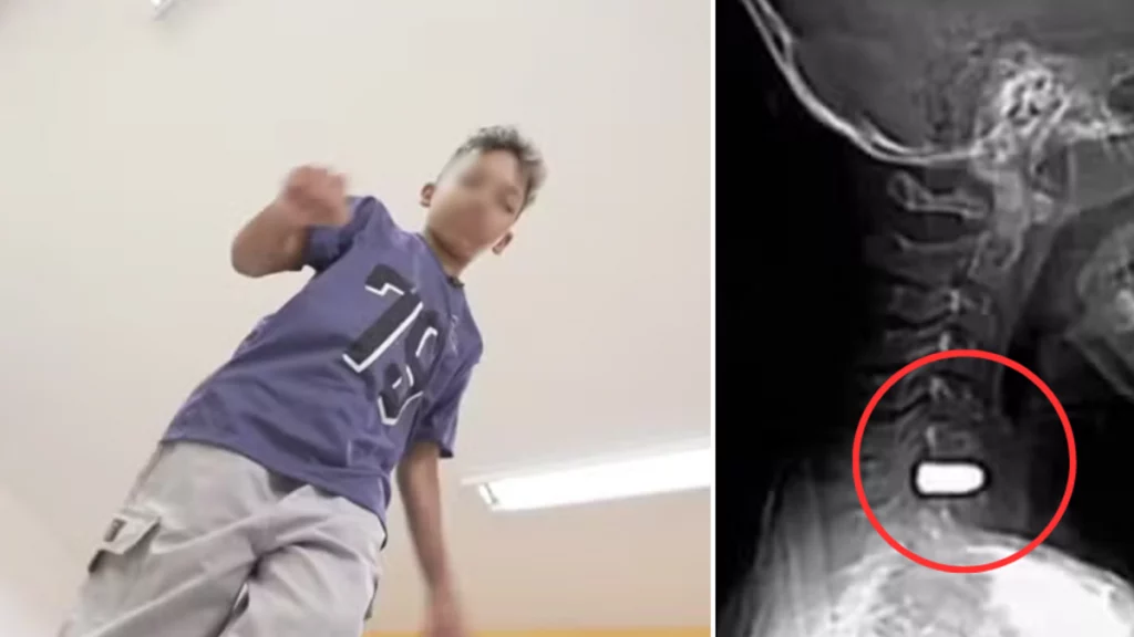 El niño que recibió una bala perdida y sorprendió a los médicos al volver a caminar pese a tener el proyecto en su columna: 'Gracias por orar'