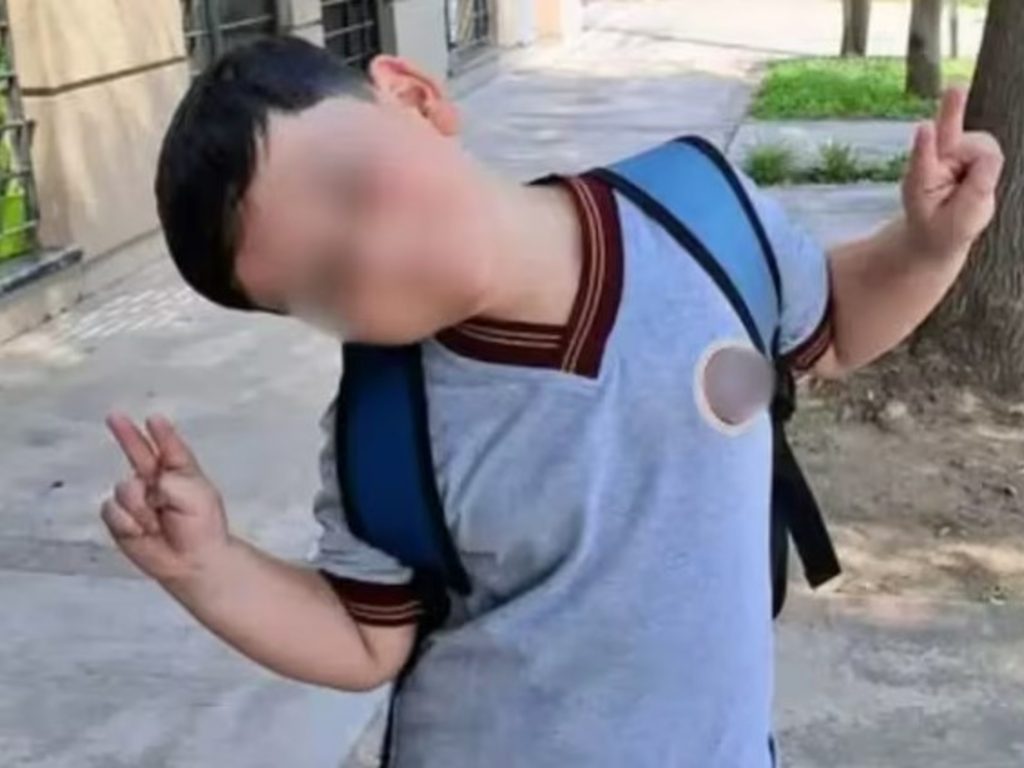 “Está respirando por sus propios medios” “Está respirando por sus propios medios”