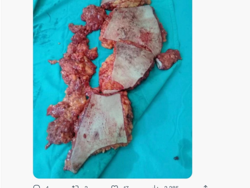 Guillermo Tofoni denunció a Pablo Toviggino por amenazas en X