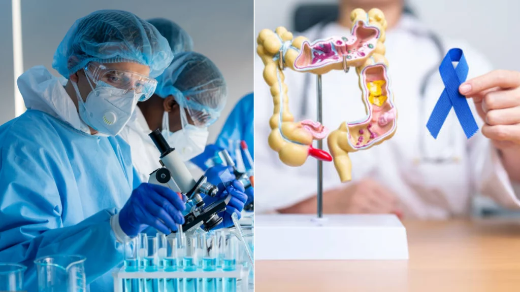 Vacuna experimental muestra resultados prometedores para prevenir el cáncer de colon en pacientes de alto riesgo