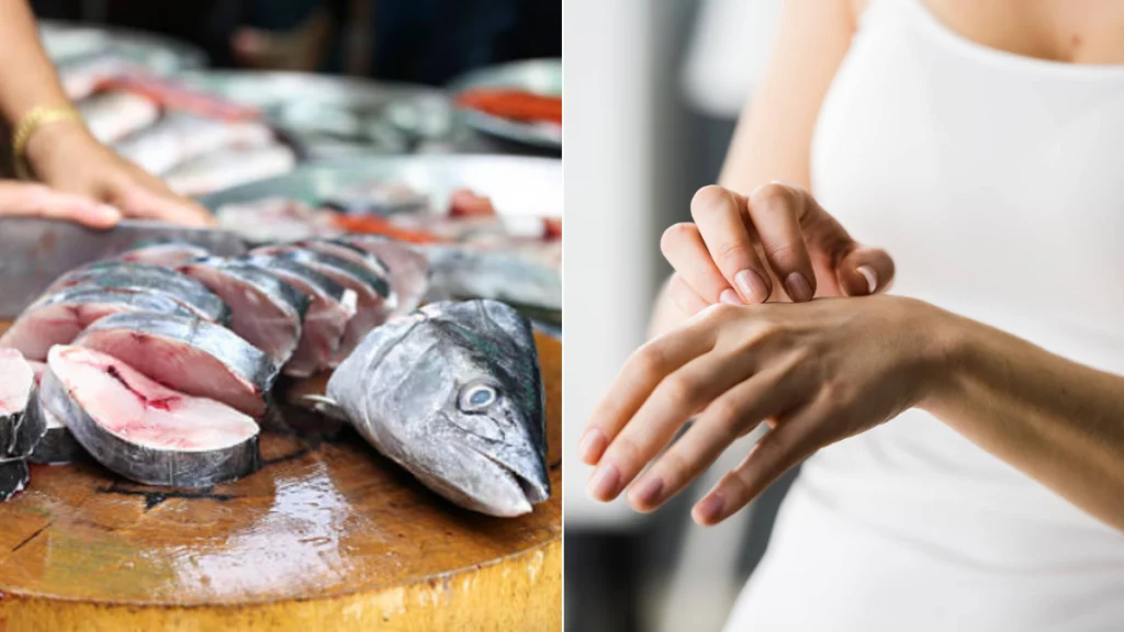¿enrojecimiento o picor tras comer pescado? Expertos explican cuándo no es alergia sino intoxicación