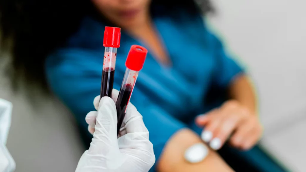 ¿Por qué es necesario asistir en ayunas a un análisis de sangre? La razón científica explicada por expertos.